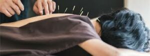 acupuncture doctor brisbane