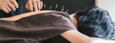 Acupuncture doctor carina
