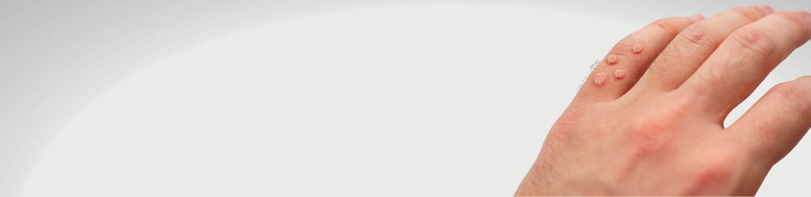 xr:d:DAE5ICLzxmc:64,j:2149739904003470372,t:23071905